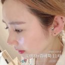 청량리11 | 포텐자 쥬베룩 청량리 피부과에서 받은 11차 후기