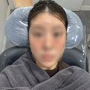 2년동안 고민하던 누워있던 귀 필러 맞기 요정귀필러 내돈내산!