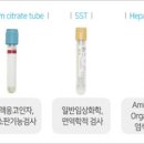 건강검진 피검사로 알수있는것 혈액검사 결과 이미지