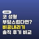 내리길 | 코 성형 부담스럽다면? 비공 내리기 시술 후기 솔직 비교