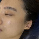 하이텐에스테틱 | 청라피부관리 잘하는곳 하이텐에스테틱