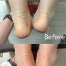 엔필라테스 이미지