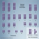 히스톤(HisTone) | 염색체(Chromosome) 이상질환, DNA, RNA, 게놈(Genome)이란 무엇인가?