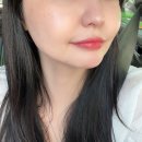 영등포 피부과 100% 만족 루비레이저 내돈내산 후기!