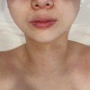 죽전 건강드림약국 | [용인피부관리] 피부결 진짜 달라졌던 '올가드림뷰티 죽전도담마을점' 토브웨이브 피부 재생관리 후기
