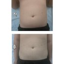 3.3 바디랩 | 단 한 번의 관리로 확인되는 확실한 슬리밍 효과