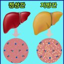 엄지의제왕) ‘구기자 식초’ 만드는 법과 효능, 간건강에 좋은음식 이미지