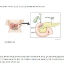 췌장암에 가장 많이 걸리는 혈액형은 바로 '이것' 이미지