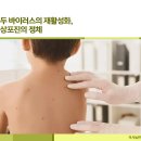 미사늘편한내과의원 | 하남미사 내과, 대상포진과 싱그릭스: 예방의 시대를 여는 새로운 백신
