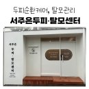 더스칼렛두피탈모센터 | 춘천 두피순환케어 받고 달라진 두피! 서주은두피탈모센터 후기