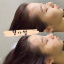 김헤어라인 이미지