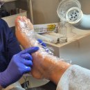 산호대로31길-1 | 구미 옥계 발각질 전문 오로지푸스 구미옥계점 건식 발각질