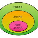 소뇌위축증 이미지