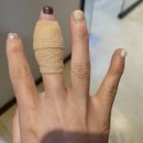 조은피부과의원 | [연세조은피부과]손가락 염증으로 찾은 피부과 방문 후기