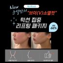 에스떼2