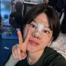 치유성형외과의원 | 치유성형외과의원에서 백설공듀 되기 (내돈내산 / 신사역성형외과)