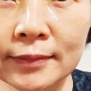 리모사 | 리모사를 만나다