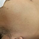 김주희 피부관리