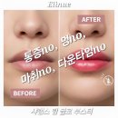 알파랩스 | [인천/부평] 입술/팔자주름 관리? 통증 없는 엘리뉴 뷰티샵 샤랩스 니들프리 후기로 촉촉한 볼륨 완성!