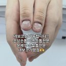 선화로73길 | 익산 물어뜯는손톱교정/ 문제성손톱 아픈손톱 관리후기