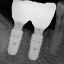 이음치과기공소 이미지