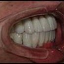 현대의수족 이미지