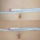 봉곡동015 | ♡복부사이즈최고로많이줄여주는곳♡구미 봉곡동 윤뷰티앤네일 - 크레이지015 복부고주파관리