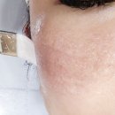 광 피부샵 본점