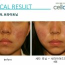 진주피부관리실 네이버블로그