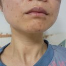 르네셀 :) 피부집중케어 할 때 쓰는 화장품 르네셀 사용후기!!