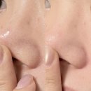 뷰티바이 LAB | 모공관리 추천템! 블루클레이 셔벗 모공 제로팩 블랙헤드 제거 후기