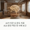 루게릭병의 새로운 치료 임상 결과 발표 이미지