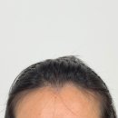 올빽