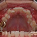 서울 가지런이 치과교정과 치과의원 이미지