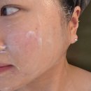 한일밋숑부분정비 | 인천 서구 피부관리 피부 트러블 고민은 '뷰티플렉스 루원시티점'