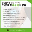 고미발톱 이미지