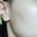 비누원 나이아신 아마이드 20% 부스터 사용후기 /고함량 미백기능성