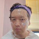 무안병원 | 목포·무안 쥐젖 사마귀 점 레이저 제거 저렴한 병원