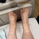 시온세탁의집 | 시온여성병원 (유도분만 실패) 제왕절개 수술/입원 후기