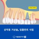 노원인플란트치과의원 이미지