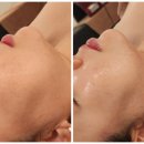 연제구-119 | [부산] 연산동 피부관리 리하에스테틱, 윤곽관리, 뼈말라 내돈내산 후기✨