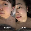 호텔 가인 | 청담경락 청담역 피부관리 얼굴형관리에 진심인 사람의 가인미가 후기