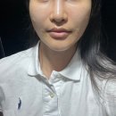 반석날마다땅콩 | 세종 콜라겐주사 탄생주사 3차 맞은후기 웨딩준비