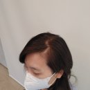 언블럿 | 대전 탈모관리/두피관리는 언블럿 대전직영점으로 오세요(MSMP관리)