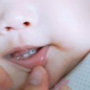 석산이사랑치과의원 이미지