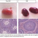 궤양성대장염과 크론병: 염증성장질환(IBD)의 원인은 무엇인가? 지놀짐+오랄짐 요법 케이스 이미지