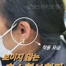 트윈스히어링 네이버블로그