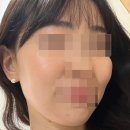 라인약국 | 약국 추천템. 건조한 겨울 필요한 고보습 라인 VT RX 후기