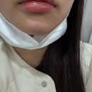 수원역 피부과 전문 병원 후기 좋은곳 추천 6곳