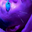 신덕한의원 | 새살침 여드름흉터치료 하면서 겪은 한의원 후기 총정리